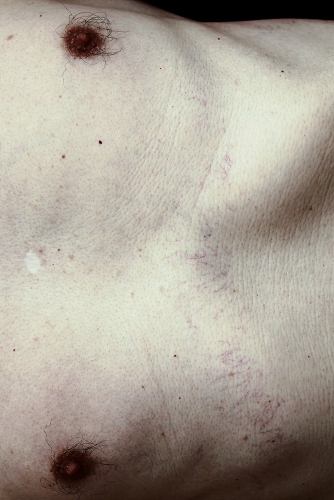 4. Anatomy